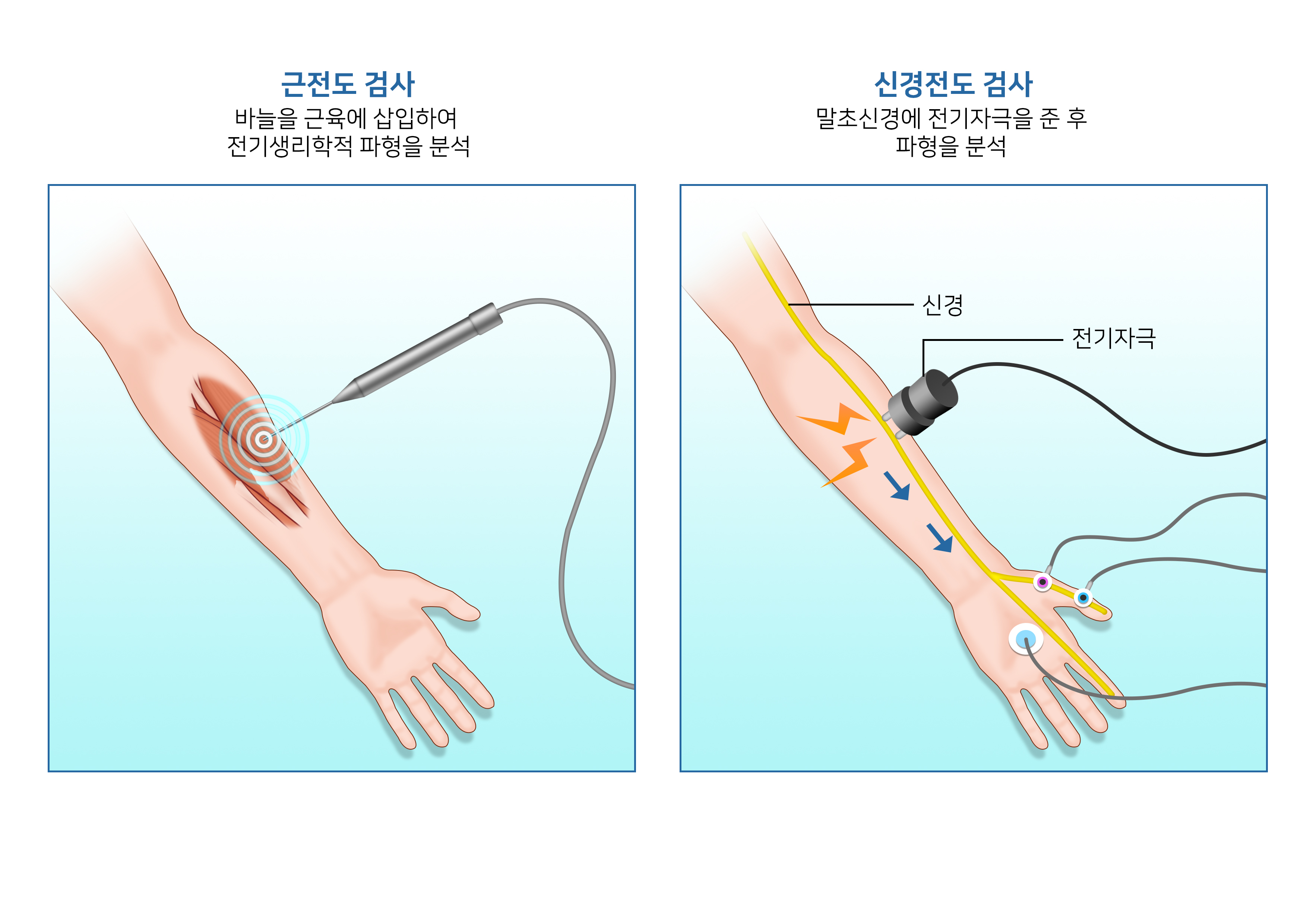 도수치료실